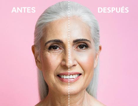 Imagen confort step